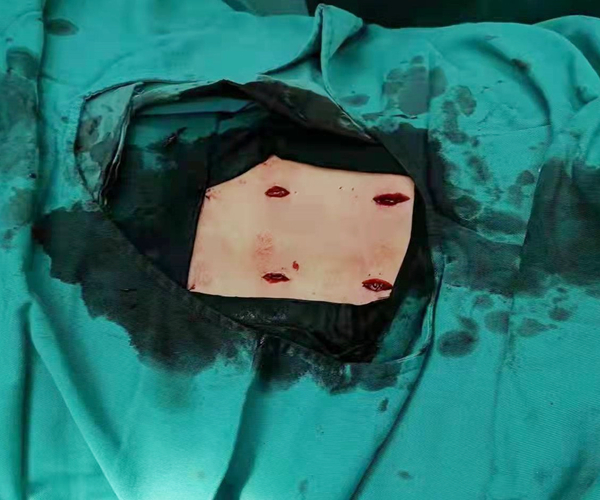 骨创1.jpg