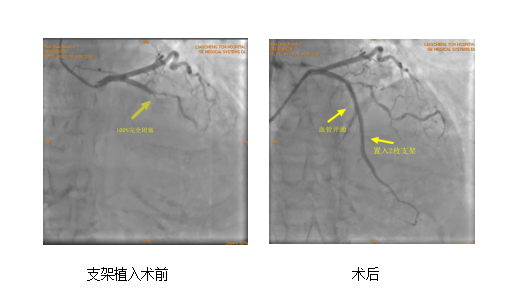 心病5.png